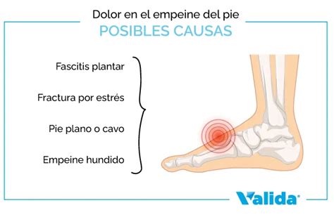 dolor empeine embarazo|dolor en la empeina.